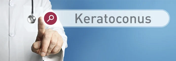 What is Keratoconus and How is it Diagnosed in Azusa CA?