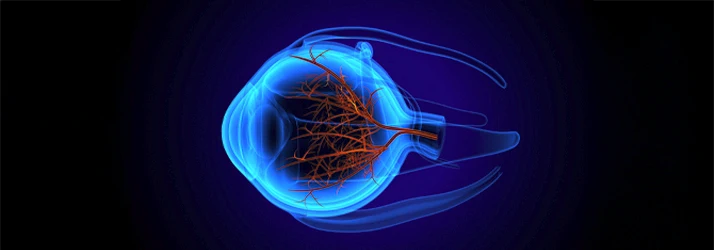 LASIK for Different Vision Conditions: Nearsightedness, Farsightedness and Astigmatism in CITY* STATE*